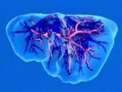 Transplantoloogia. Väljakutse surmale